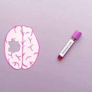 Blood test detects signs of Alzheimer’s disease in midlife