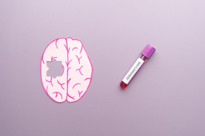 <p style="text-align: justify;"><span>Blood test can identify signs of accumulation of highly accurate <a href="https://www.m