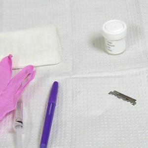 Novel SGUS score identifies SjD patients in need, or not, of biopsy