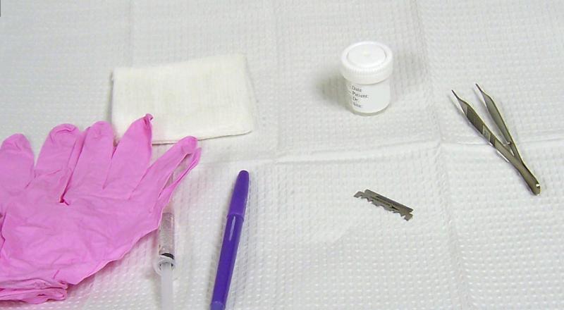 Novel SGUS score identifies SjD patients in need, or not, of biopsy