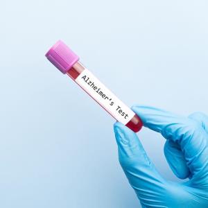 Blood test enables physicians to rule out Alzheimer’s disease in primary care