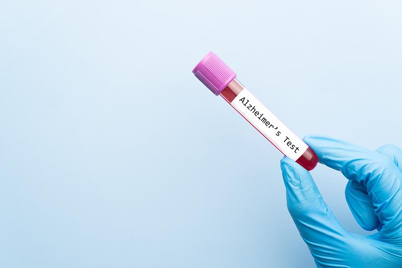 Blood test enables physicians to rule out Alzheimer’s disease in primary care