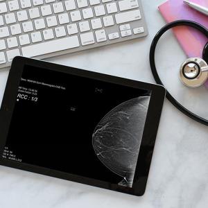 Is AI-assisted breast cancer screening cost-effective?