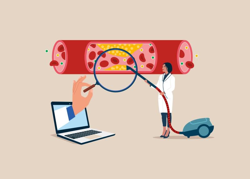 Perfusion studies enhance benefits of mechanical thrombectomy for stroke beyond 6-hour window