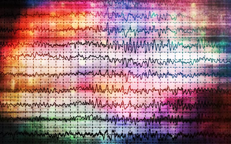 Fenfluramine works in paediatric, adult patients with developmental/epileptic encephalopathies