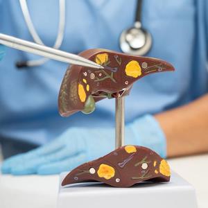 Direct-acting antivirals improve survival in patients with HCV-related HCC