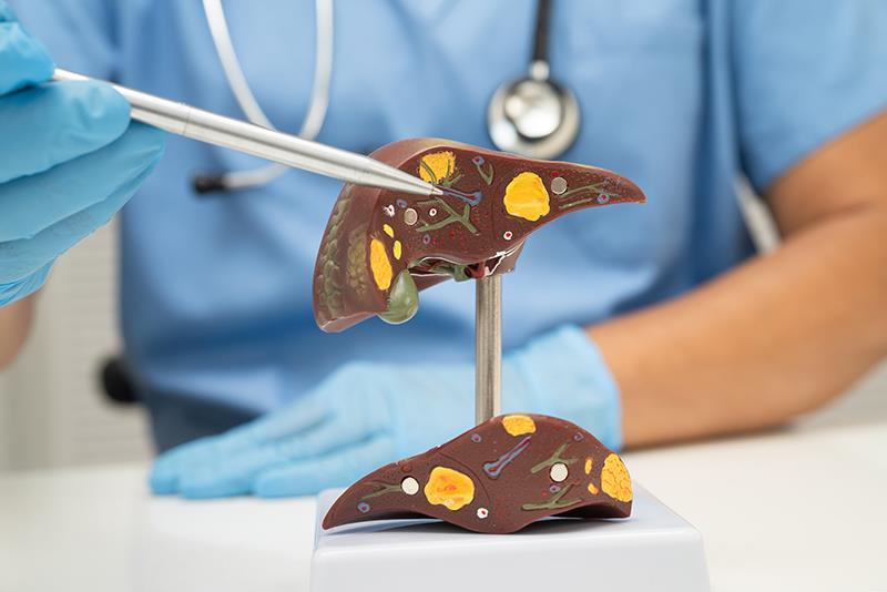 Direct-acting antivirals improve survival in patients with HCV-related HCC