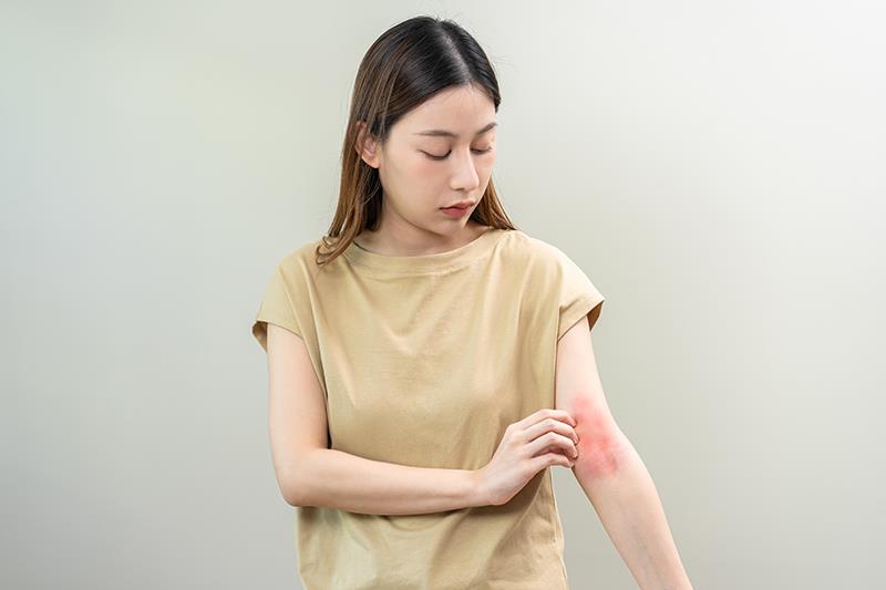 Dupilumab improves AD symptoms in adult Asians