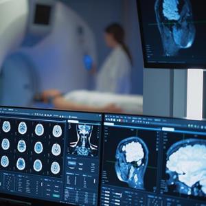 Early-onset RIL in glioblastoma patients treated with STUPP warrants monitoring