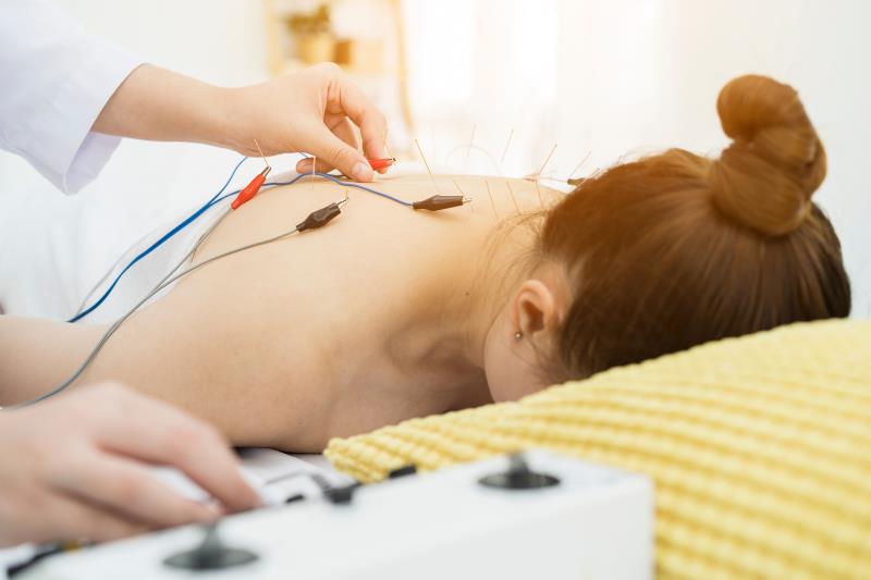 Electroacupuncture a potential nonpharmacologic option for managing postherpetic neuralgia