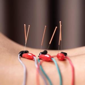 Electroacupuncture offers symptom relief in knee OA