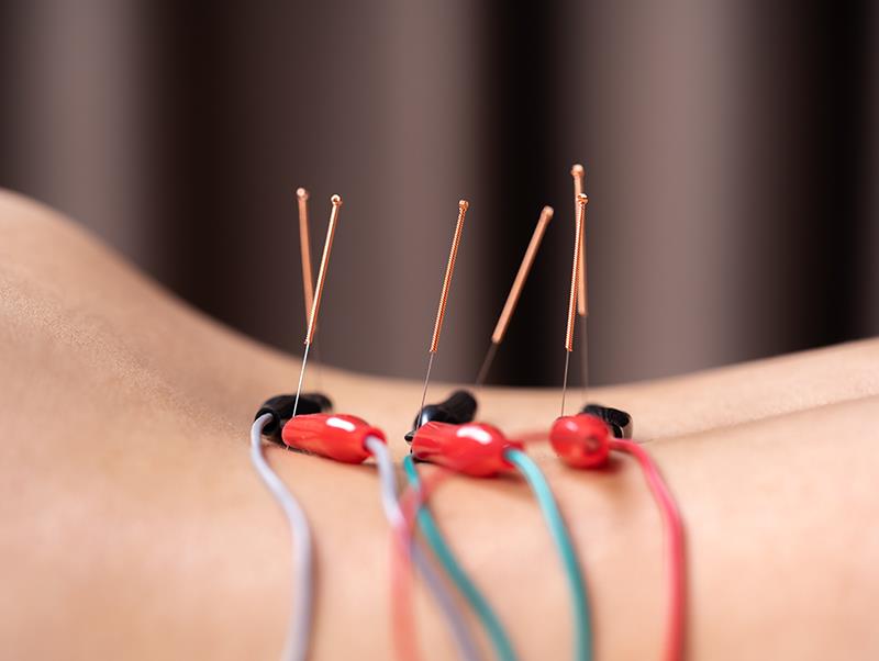 Electroacupuncture offers symptom relief in knee OA