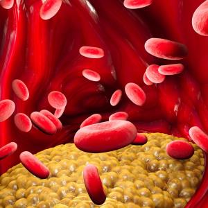 Novel oral small-molecule PCSK9 inhibitor shows promise in hypercholesterolemia
