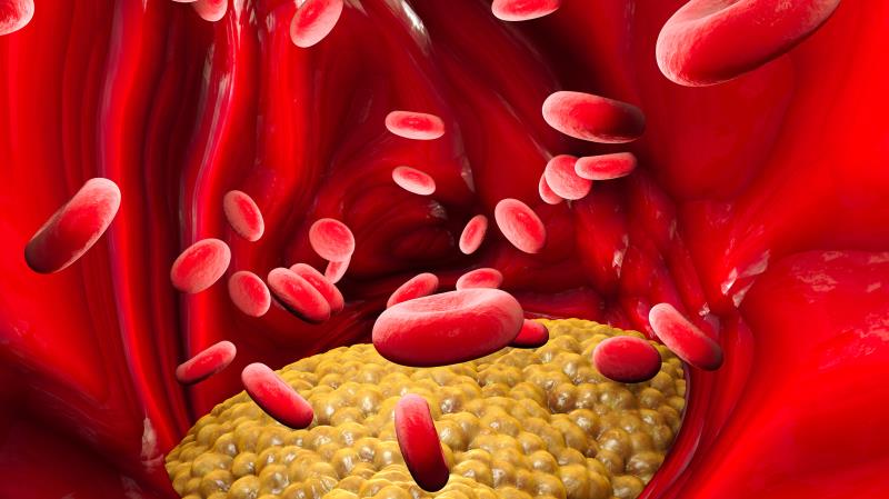 Novel oral small-molecule PCSK9 inhibitor shows promise in hypercholesterolemia