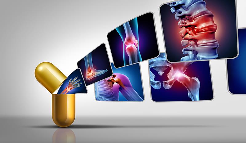 A sublingual formulation of cyclobenzaprine may be new treatment option for fibromyalgia.