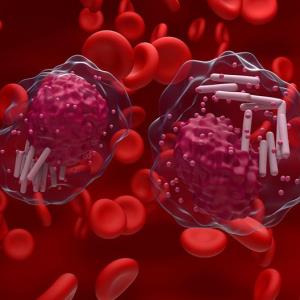 1-year fixed-duration venetoclax-obinutuzumab goes a long way in CLL