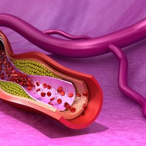 Vitamin K homologue menaquinone-7 supplementation may attenuate coronary artery calcification