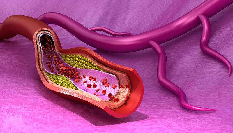 Vitamin K homologue menaquinone-7 supplementation may attenuate coronary artery calcification