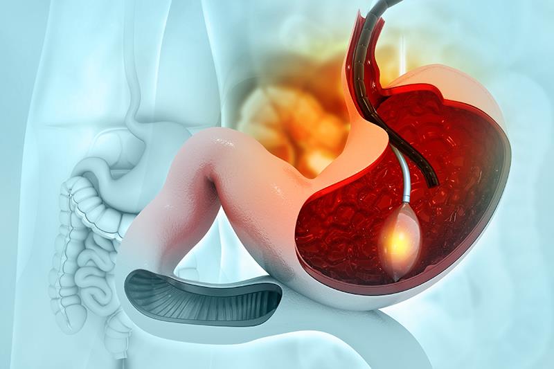 Continuous vs bolus infusion of terlipressin: Which works best in acute variceal haemorrhage?