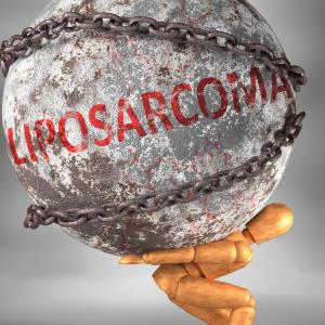 Eribulin in liposarcoma: Clinical benefit and guideline recommendations