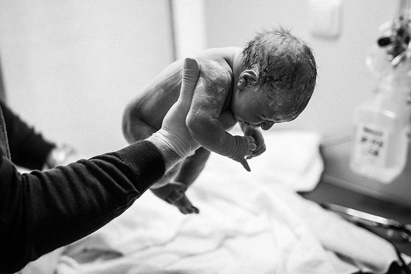 LBW is associated with increased risks of infant morbidity and mortality, developmental delays, and long-term health issues.