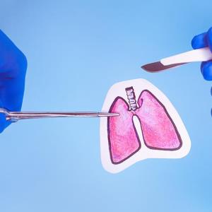 Lung transplant shows signal of benefit in select lung cancer patients