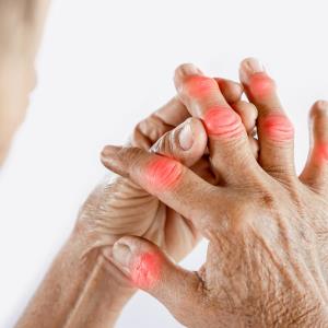 Lifestyle factors, comorbidities linked to difficult-to-treat rheumatoid arthritis