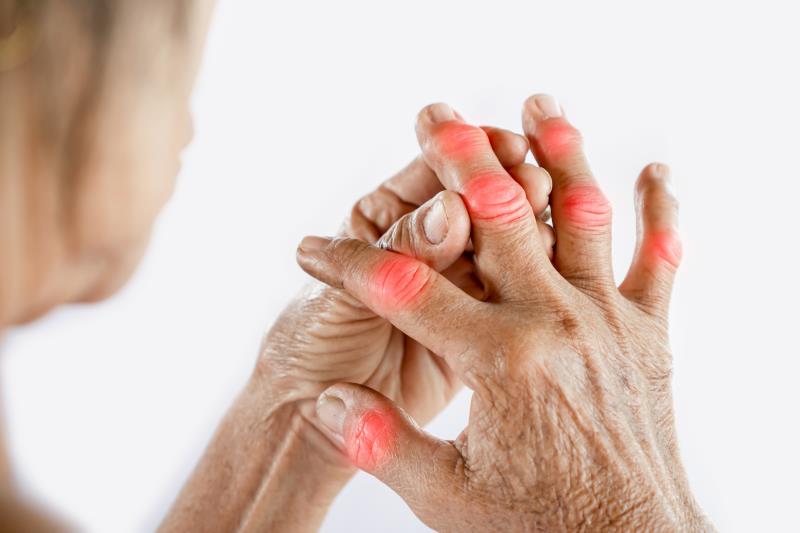 Difficult-to-treat rheumatoid arthritis is associated with smoking, obesity, fibromyalgia, and depression, according to the r
