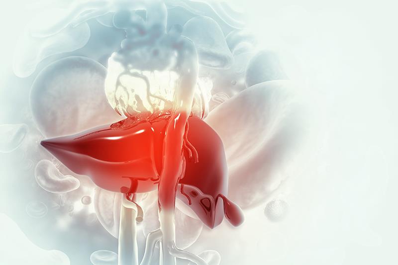 MELD best predictor of outcomes in alcohol-related liver disease: study