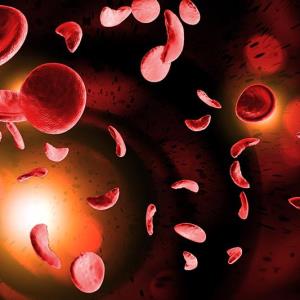 Mitapivat RISEs UP as a potential Tx alternative for sickle cell disease