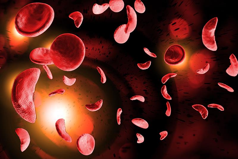 The pivotal RISE UP study is the first to validate PK activation as a new treatment paradigm in sickle cell disease.