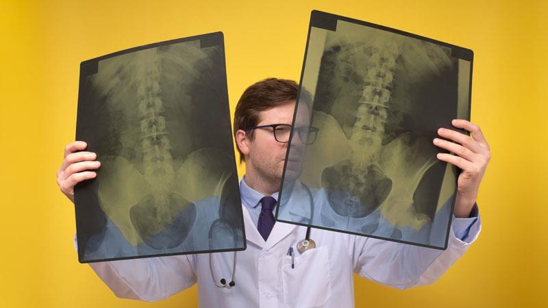 The findings mark a breakthrough for patients with MOGAD.