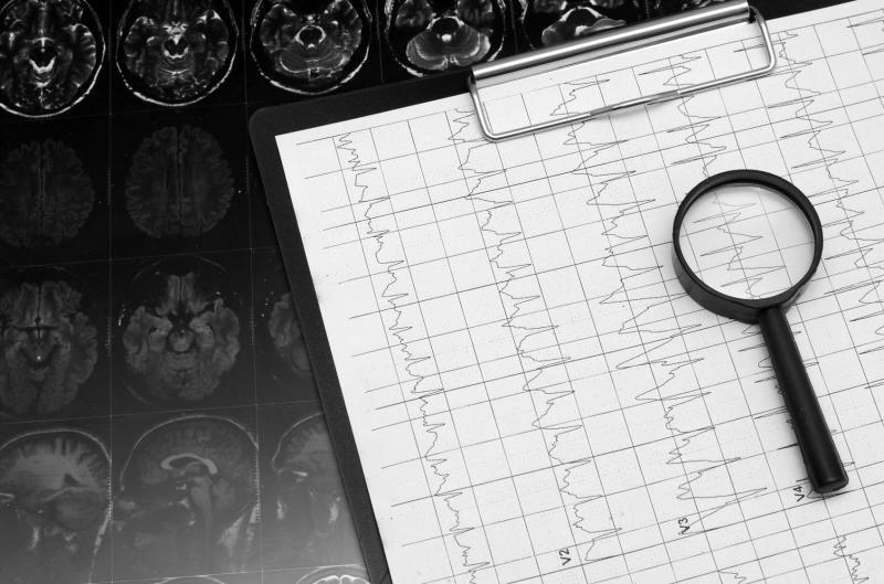 Cenobamate for epilepsy effective across multiple treatment lines