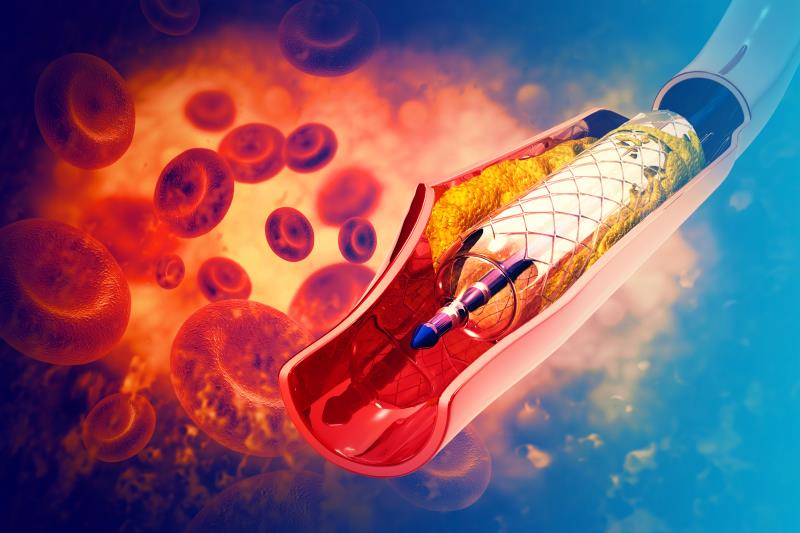 Abbreviated DAPT found safe in high-risk patients undergoing PCI