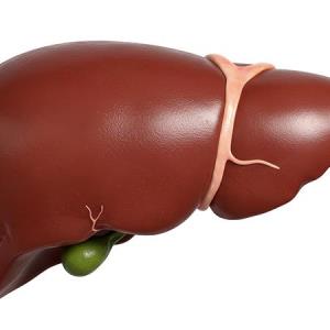 Bringing Life Back by Treating MASLD: A Case Report