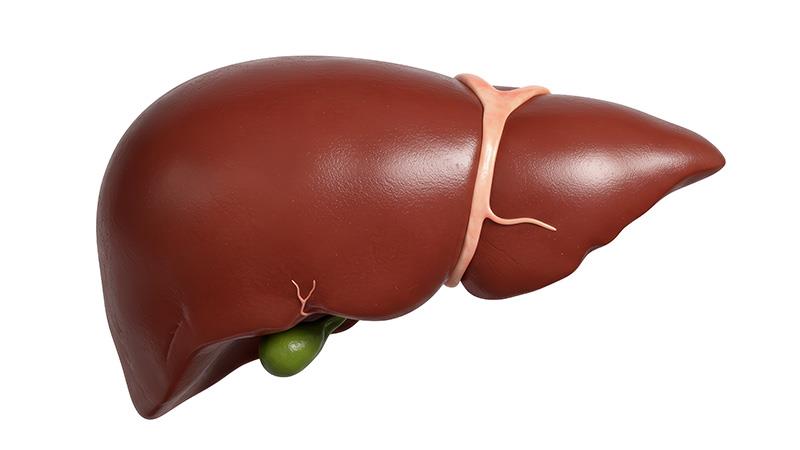 Bringing Life Back by Treating MASLD: A Case Report