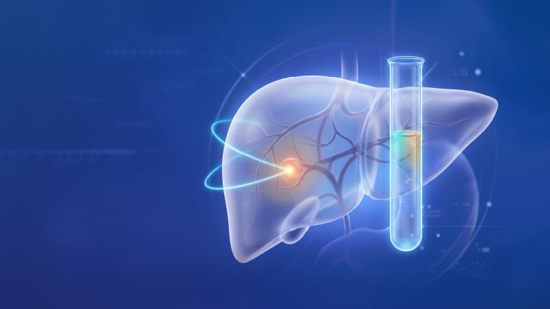 Advancing HCC Surveillance:
The Clinical Case for Integrated
Risk Assessment