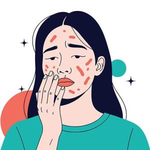 Topical ivermectin, encapsulated benzoyl peroxide come first among rosacea medications