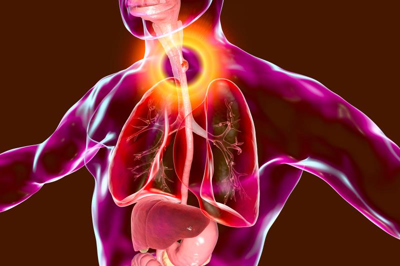 Camrelizumab plus apatinib shows promising safety, efficacy in ESCC