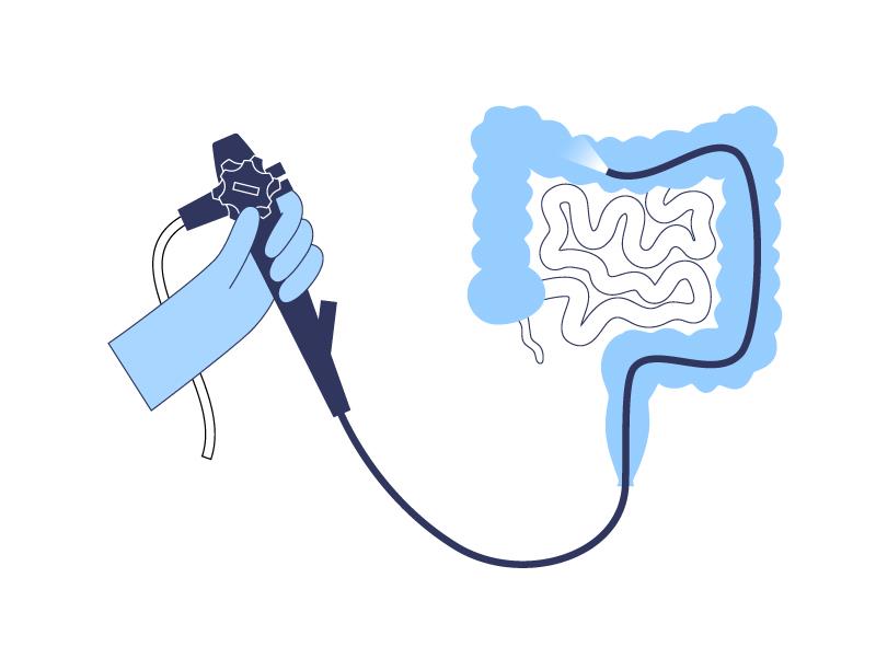 Novel single-use colonoscope viable, but imaging enhancements needed