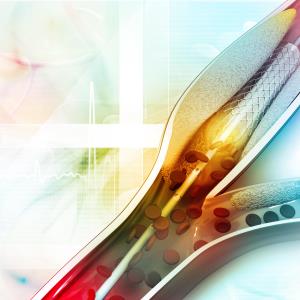 PCI outclasses OMT for chronic total coronary occlusion