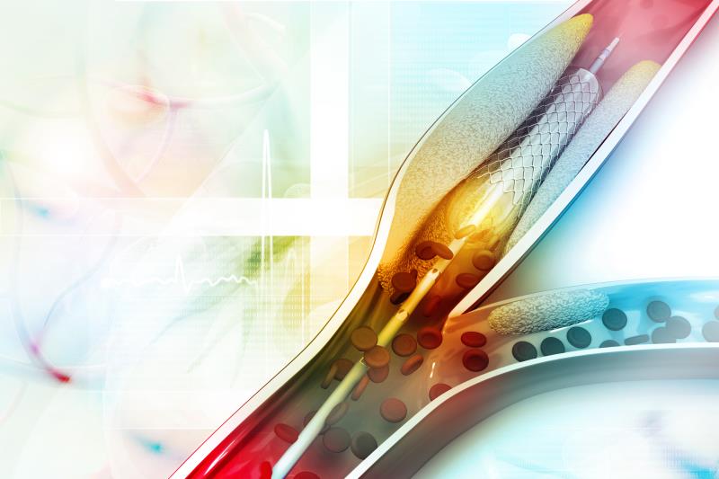 PCI outclasses OMT for chronic total coronary occlusion