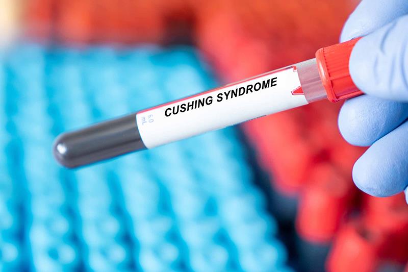 Improved cardiometabolic outcomes seen after surgical remission of endogenous hypercortisolism