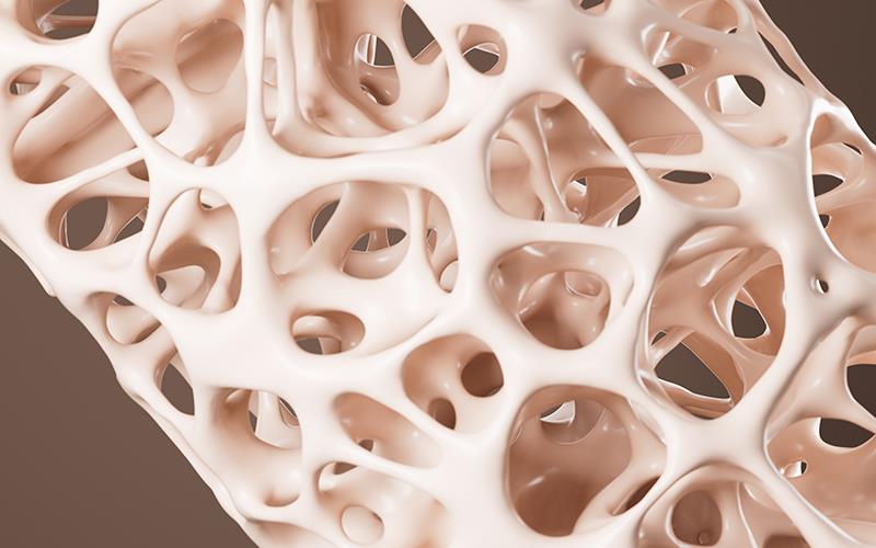 Pulse steroid therapy tied to bone turnover marker suppression, but not BMD loss