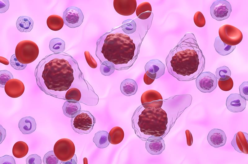 Selinexor-ruxolitinib combo improves SVR in patients with JAKi-naïve myelofibrosis