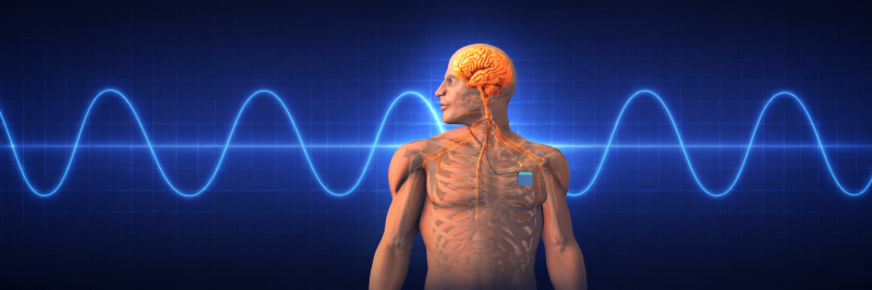 Transcutaneous electrical nerve stimulation: Promising adjunct in stroke rehabilitation