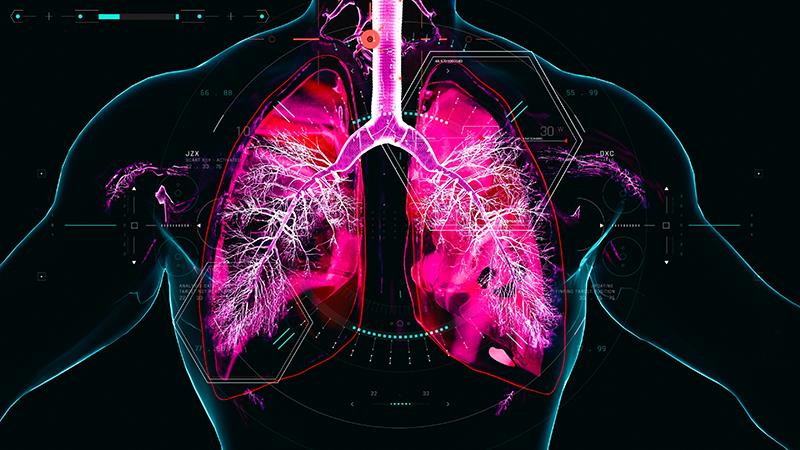Chronic airway diseases linked to increased pertussis infection risk