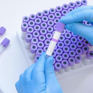 Universal SARS-CoV-2 screening of limited benefit during low-incidence periods