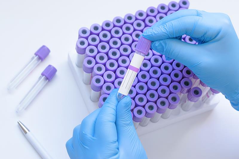 Universal SARS-CoV-2 screening of limited benefit during low-incidence periods