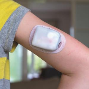 Suboptimal use of diabetes management technology in children and adolescents with T1D